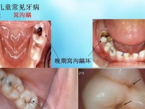 多喝牛奶的坏处（揭示多喝牛奶的健康隐患，让你远离风险）